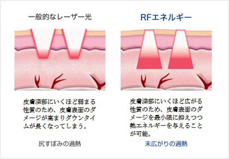 eマトリックス