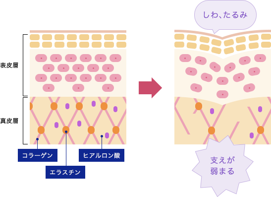 ハリとは