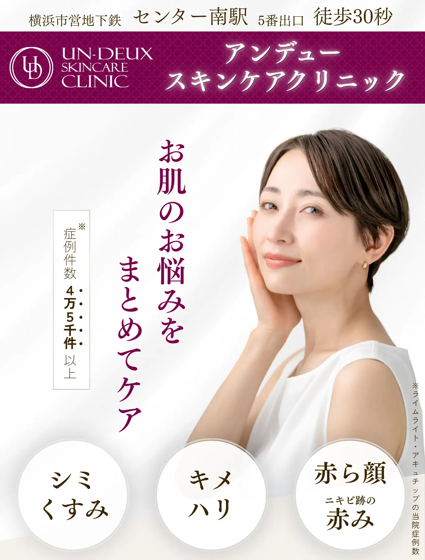 アンデュー スキンケアクリニックの広告画像。お肌のお悩みをまとめてケア、シミ・くすみ、キメ・ハリ、赤ら顔やニキビ跡の赤みへの訴求、症例件数4万5000件以上