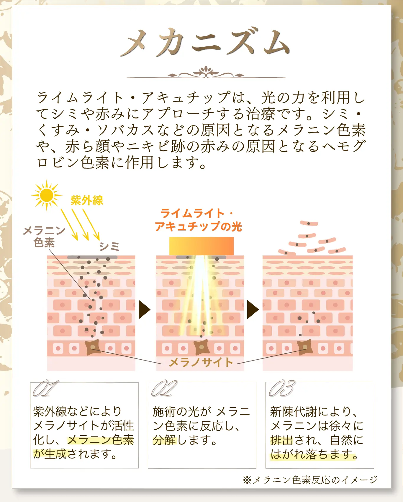ライムライトとアキュチップのメカニズム説明。紫外線によるメラニン生成から、光照射で分解し新陳代謝で排出されるまでの流れを図解