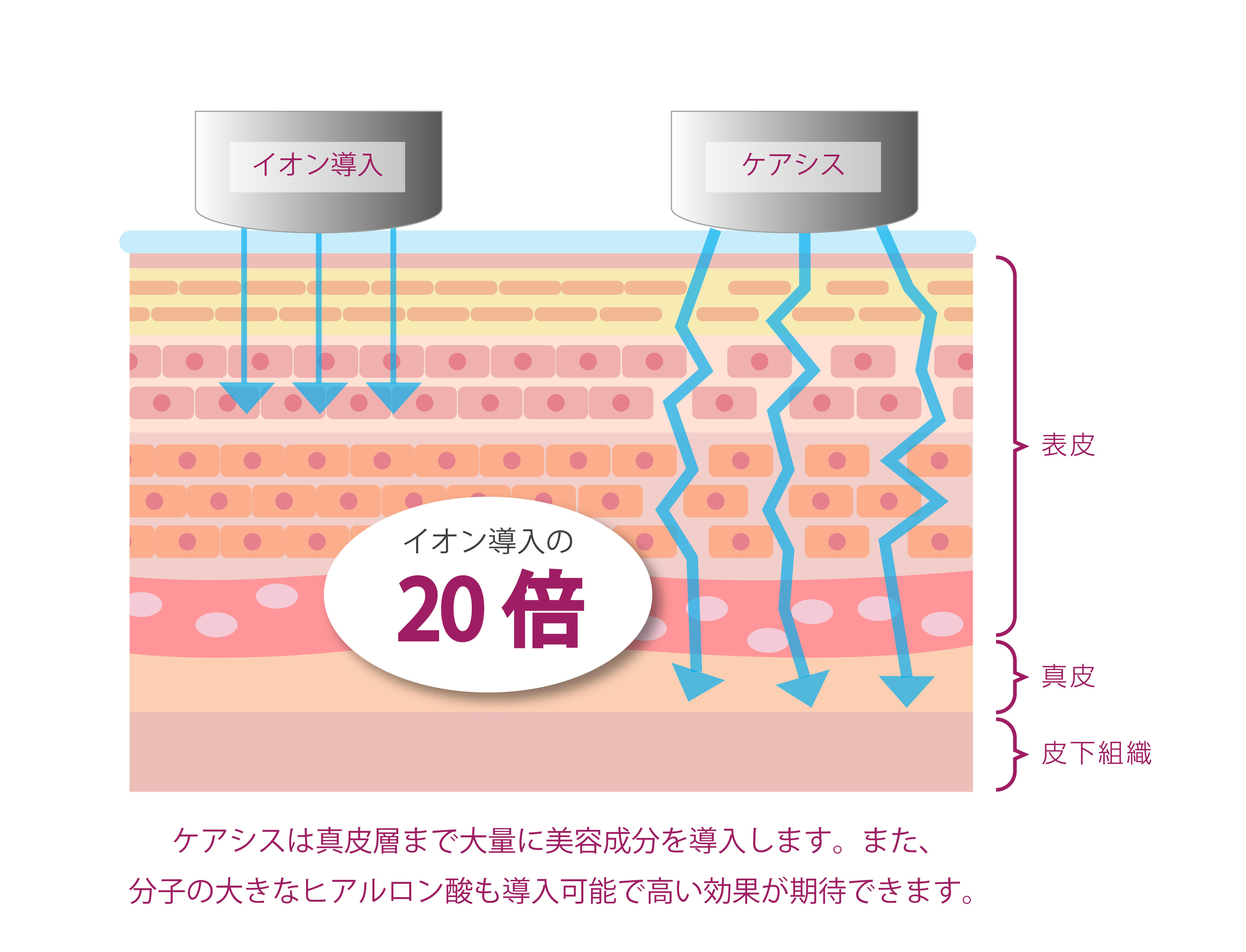 イオン導入とケアシス（エレクトロポレーション）の違い.jpg