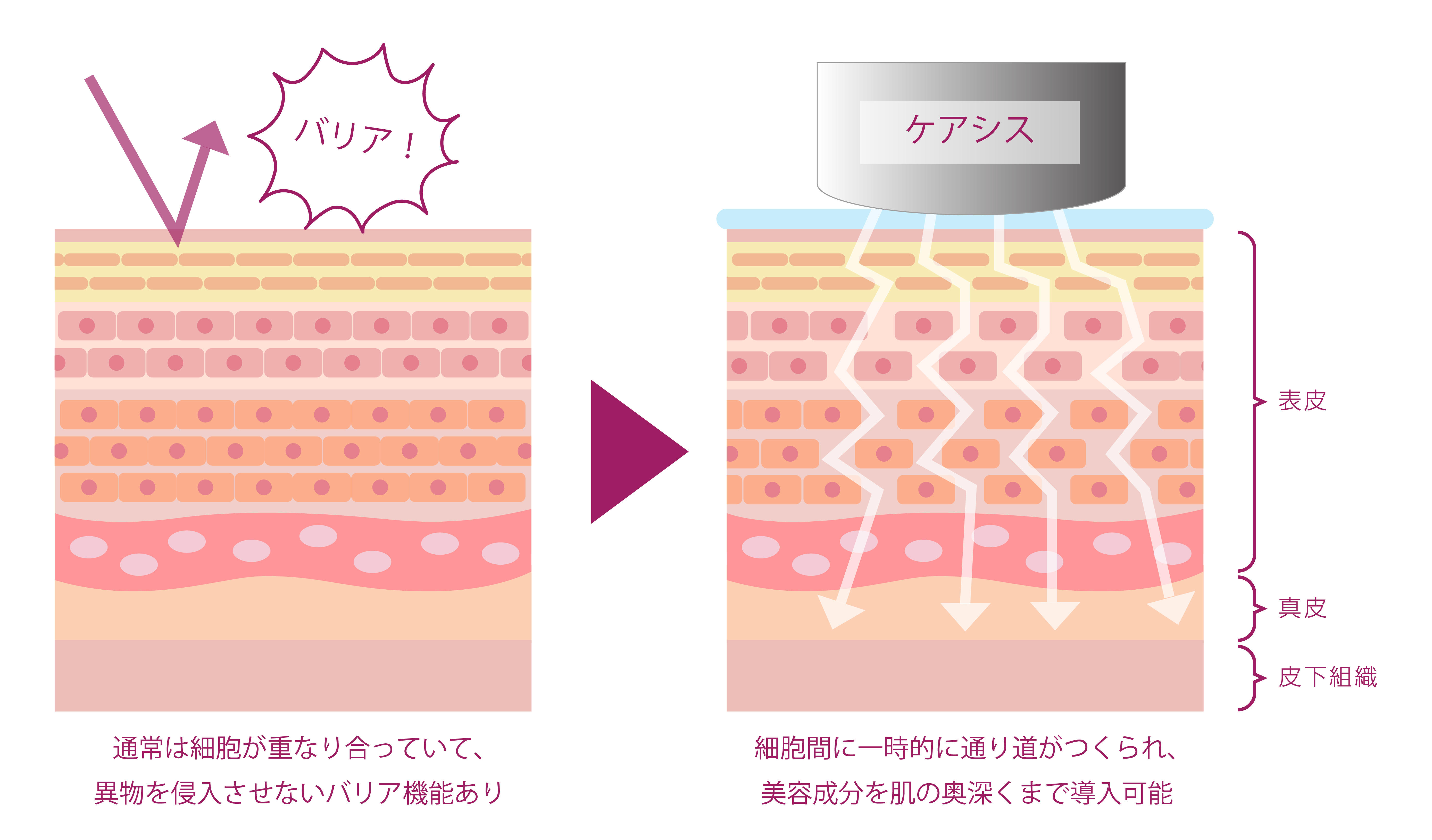 ケアシス（エレクトロポレーション）のしくみ.jpg