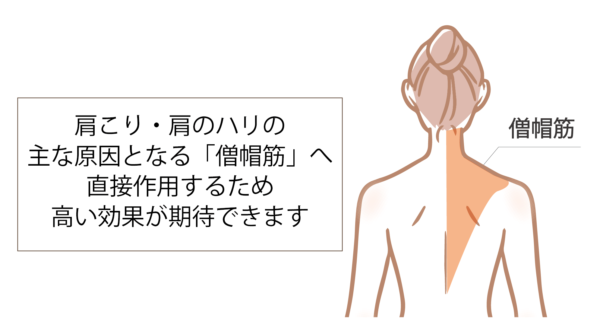 肩こりの要因僧帽筋.png