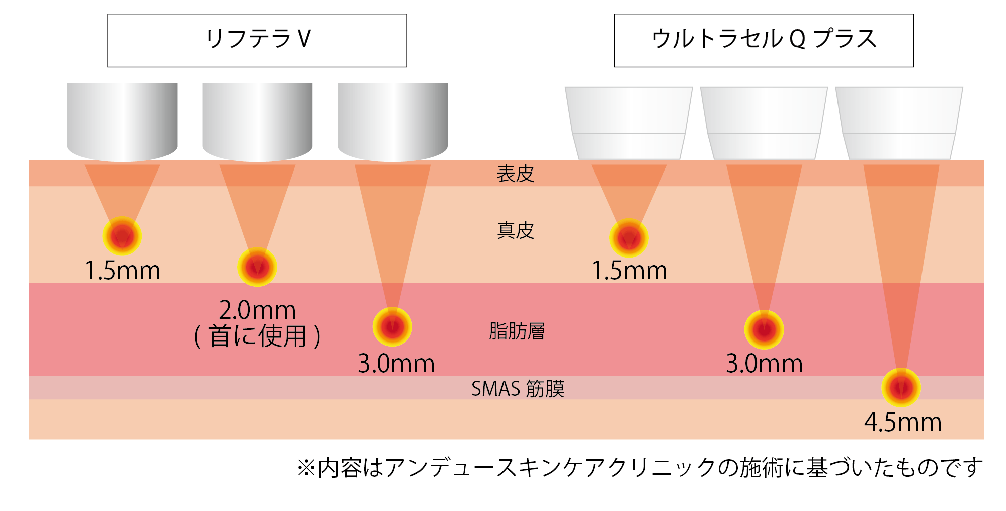 リフテラVとウルトラセルQプラスの違い（照射深度）.png