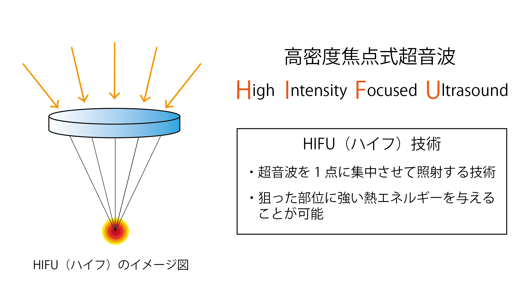 HIFU（ハイフ）とは.png