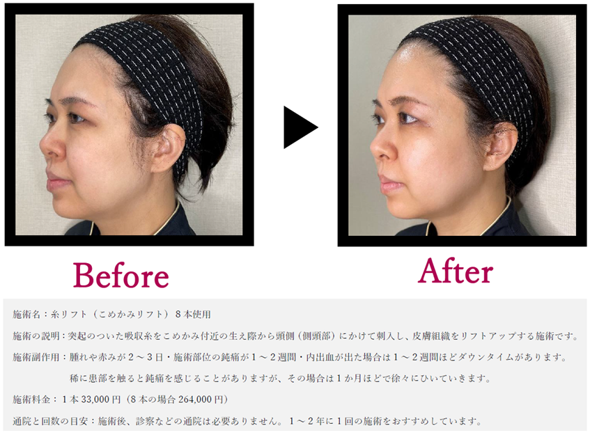 before・after.png