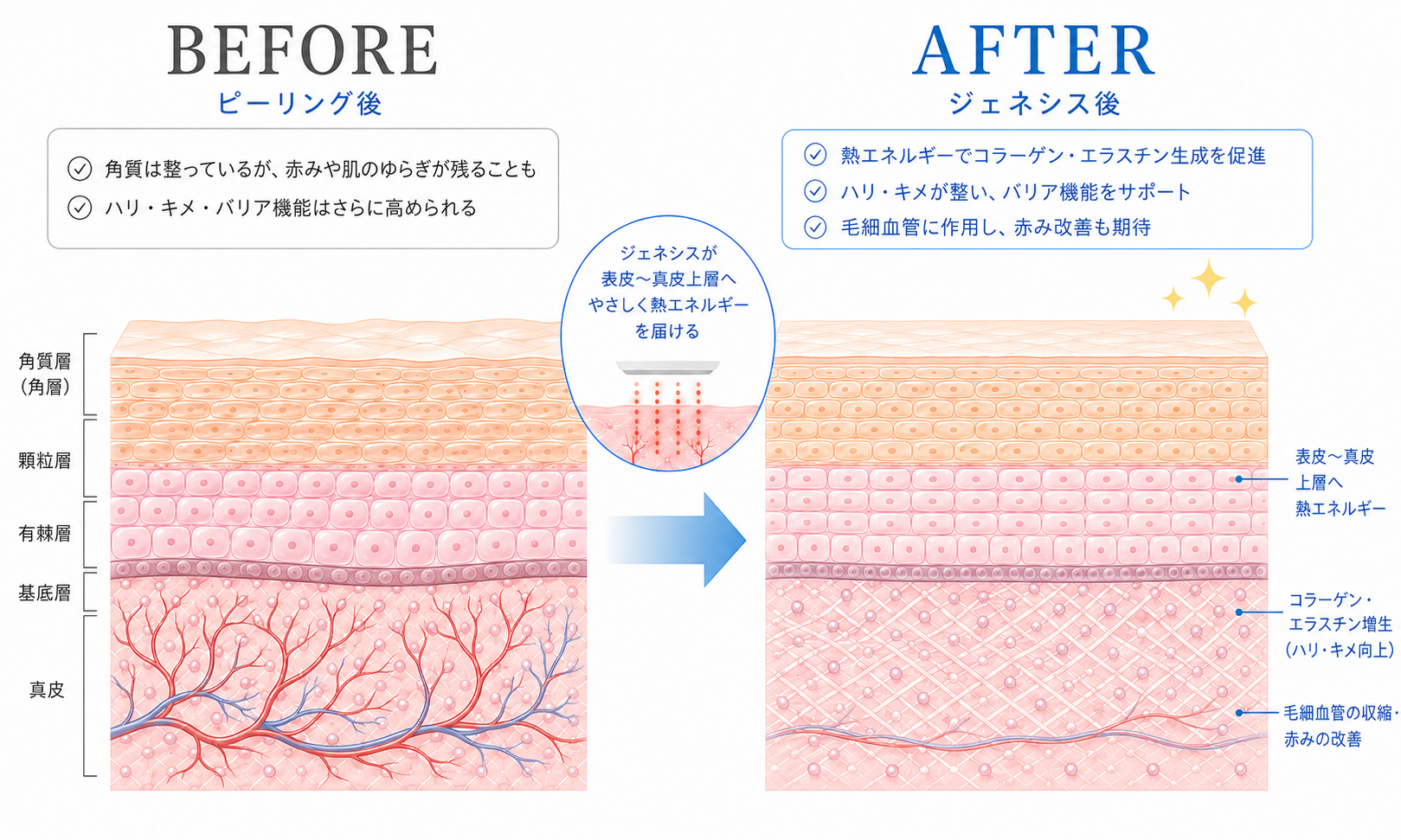 ジェネシスイメージ.png