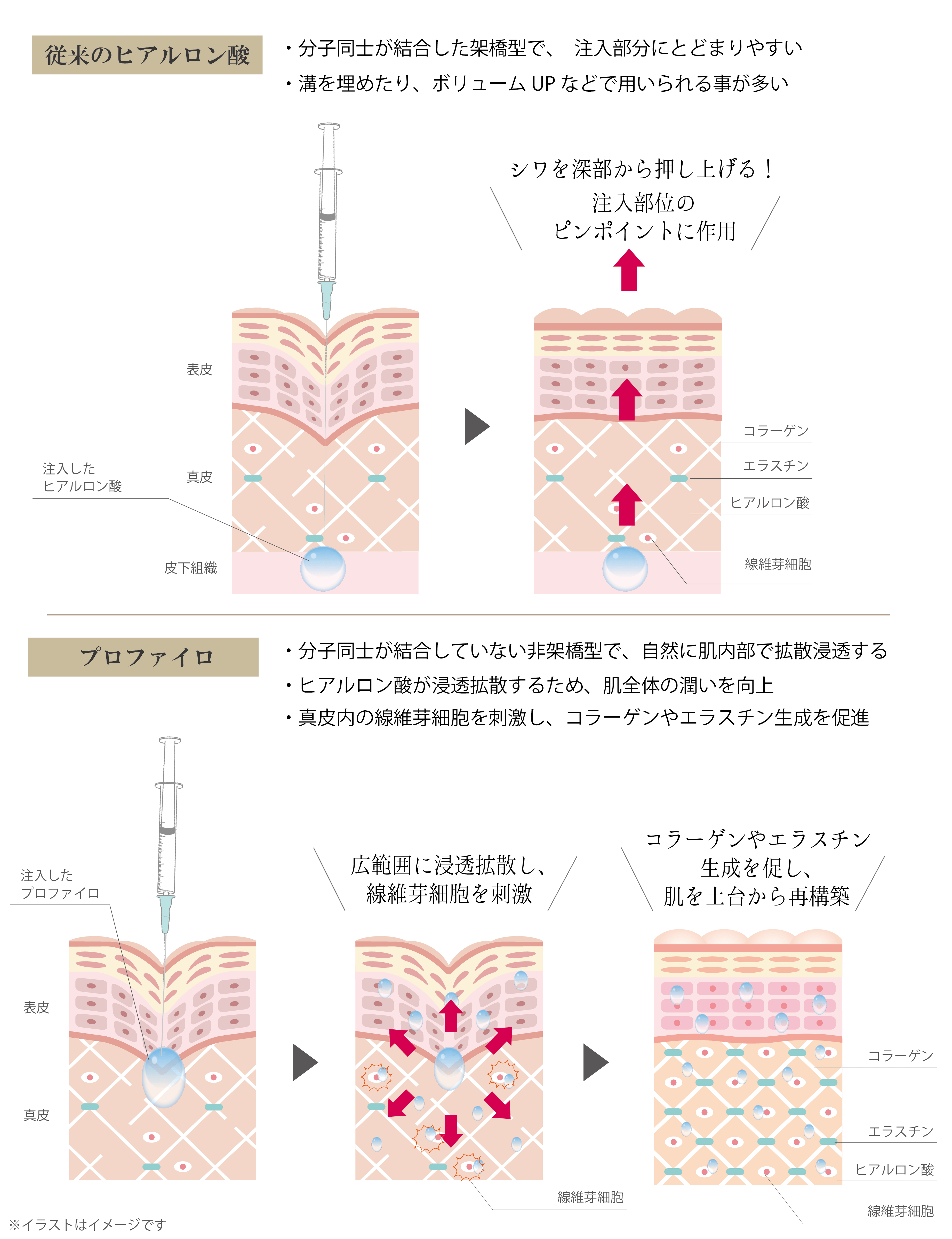 ヒアルロン酸とプロファイロの違い.png