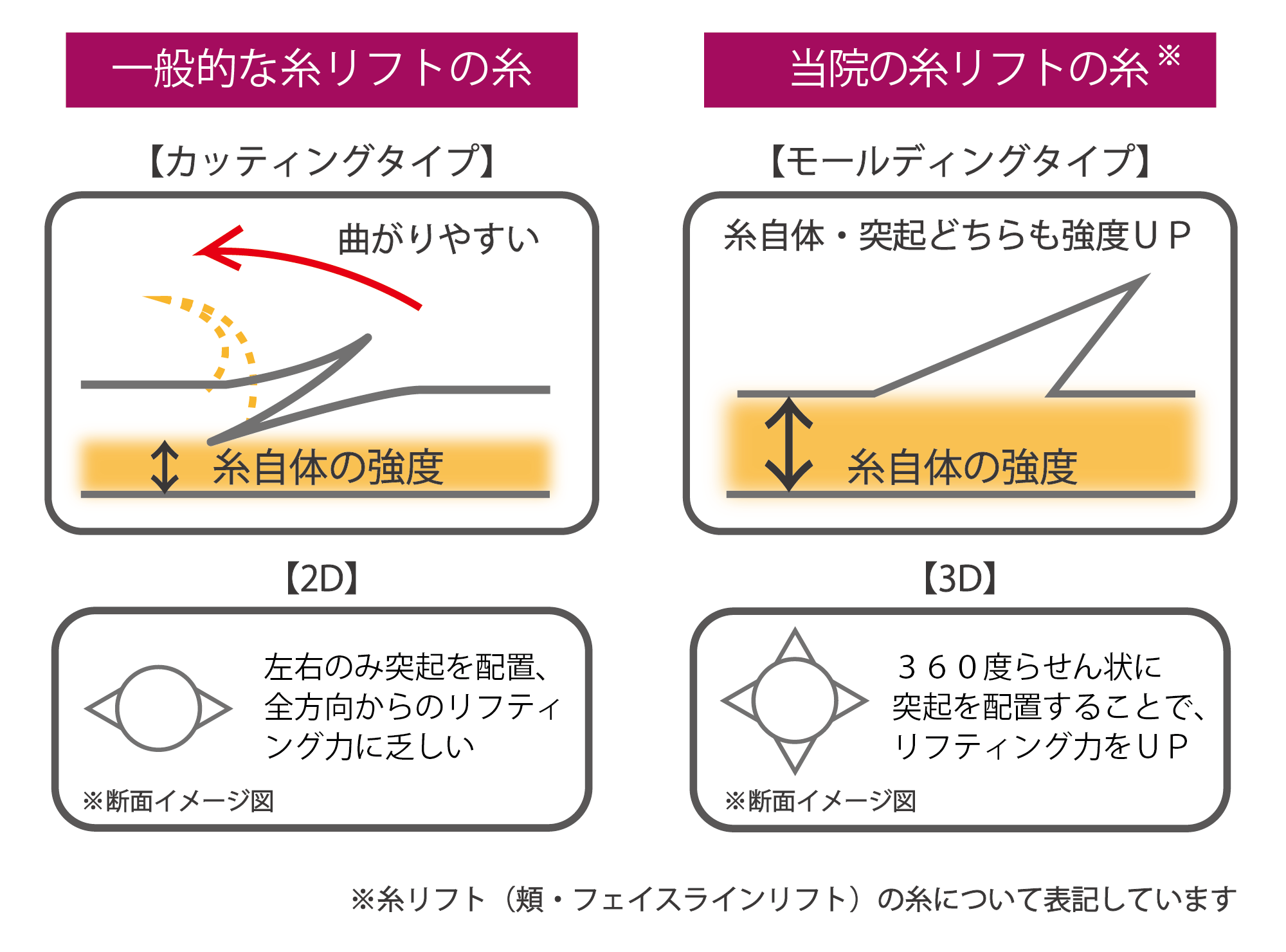 糸リフトのカッティングタイプとモールディングタイプの違い.png