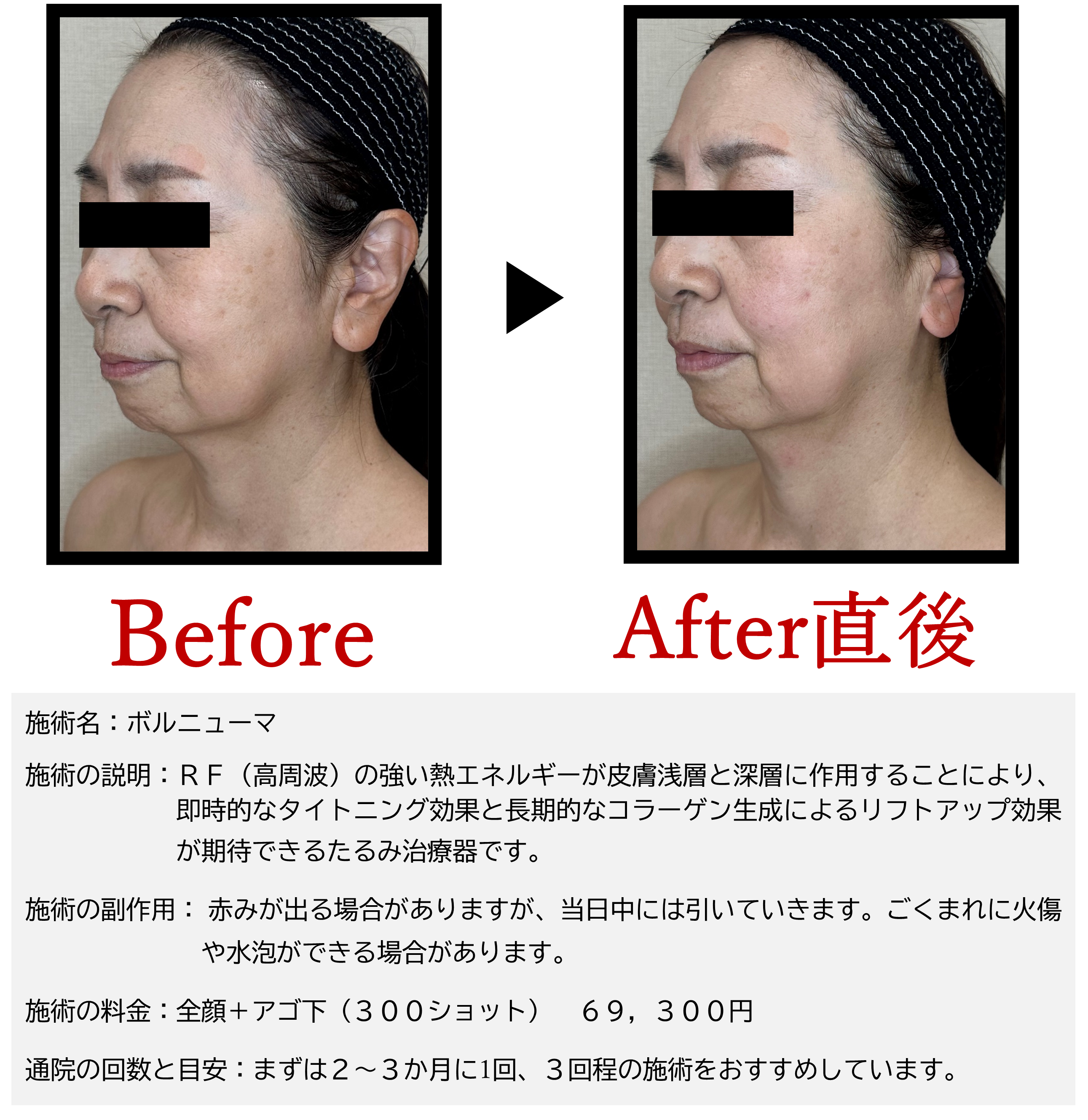 当日BA　駒井さん.png