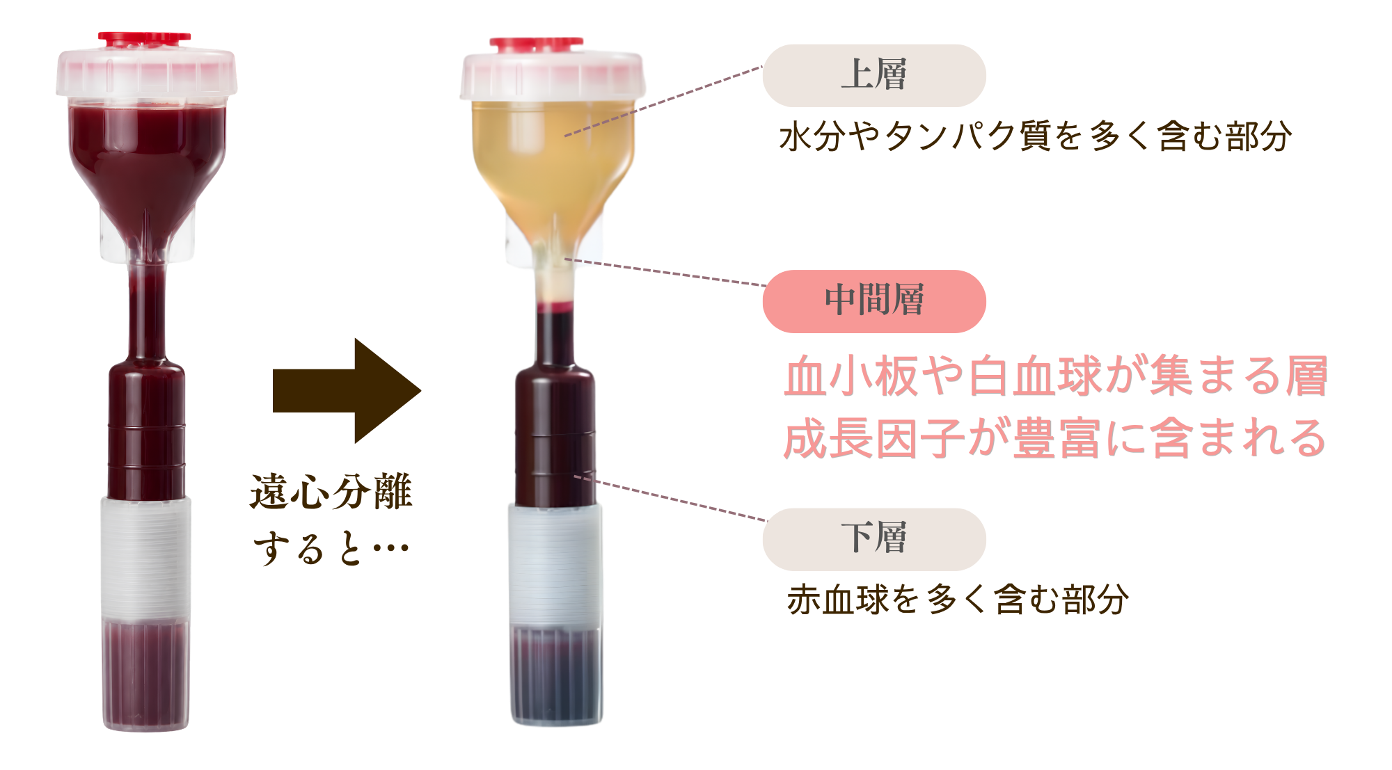 W-PRP皮膚再生治療の抽出方法.png