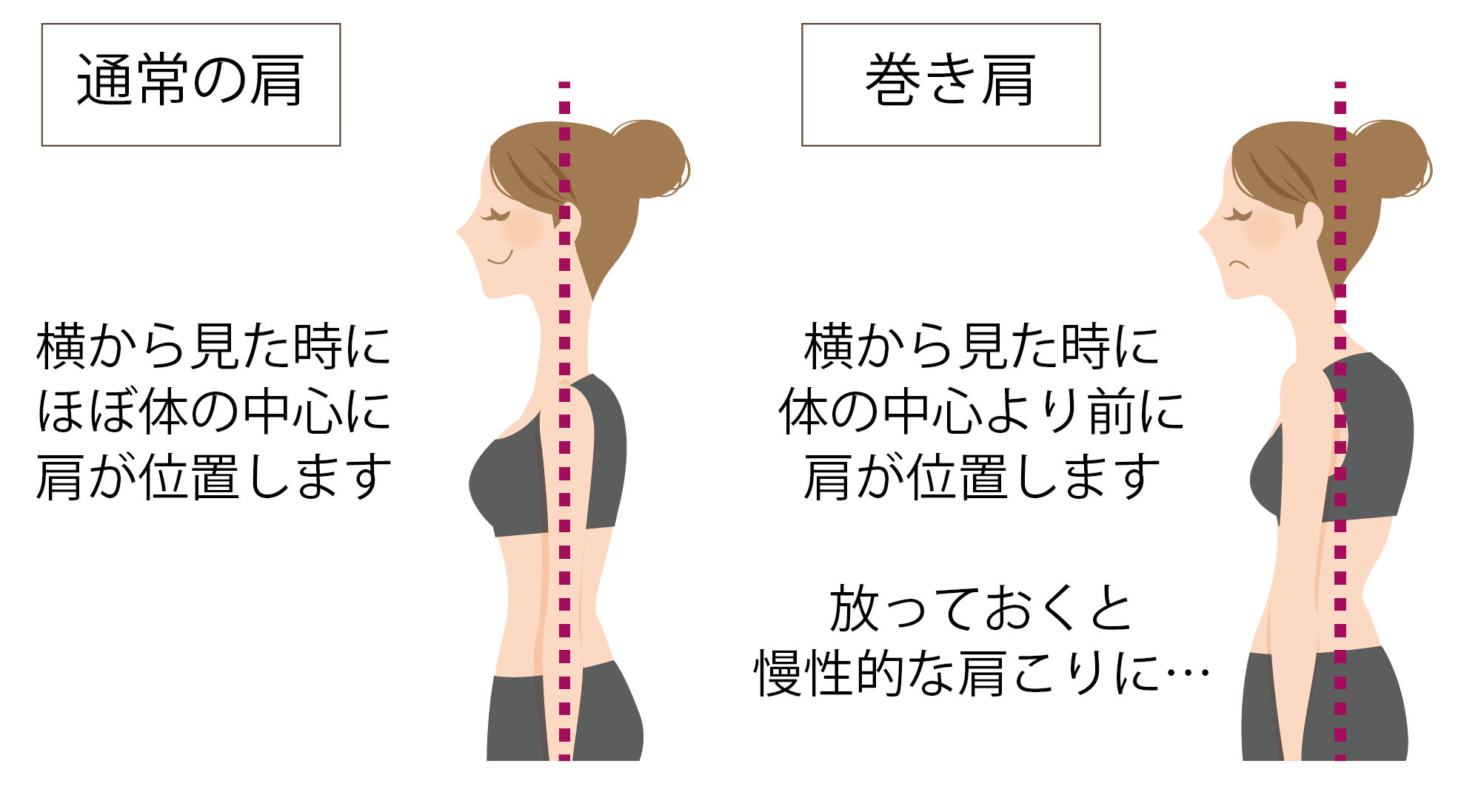 巻き肩とは.png