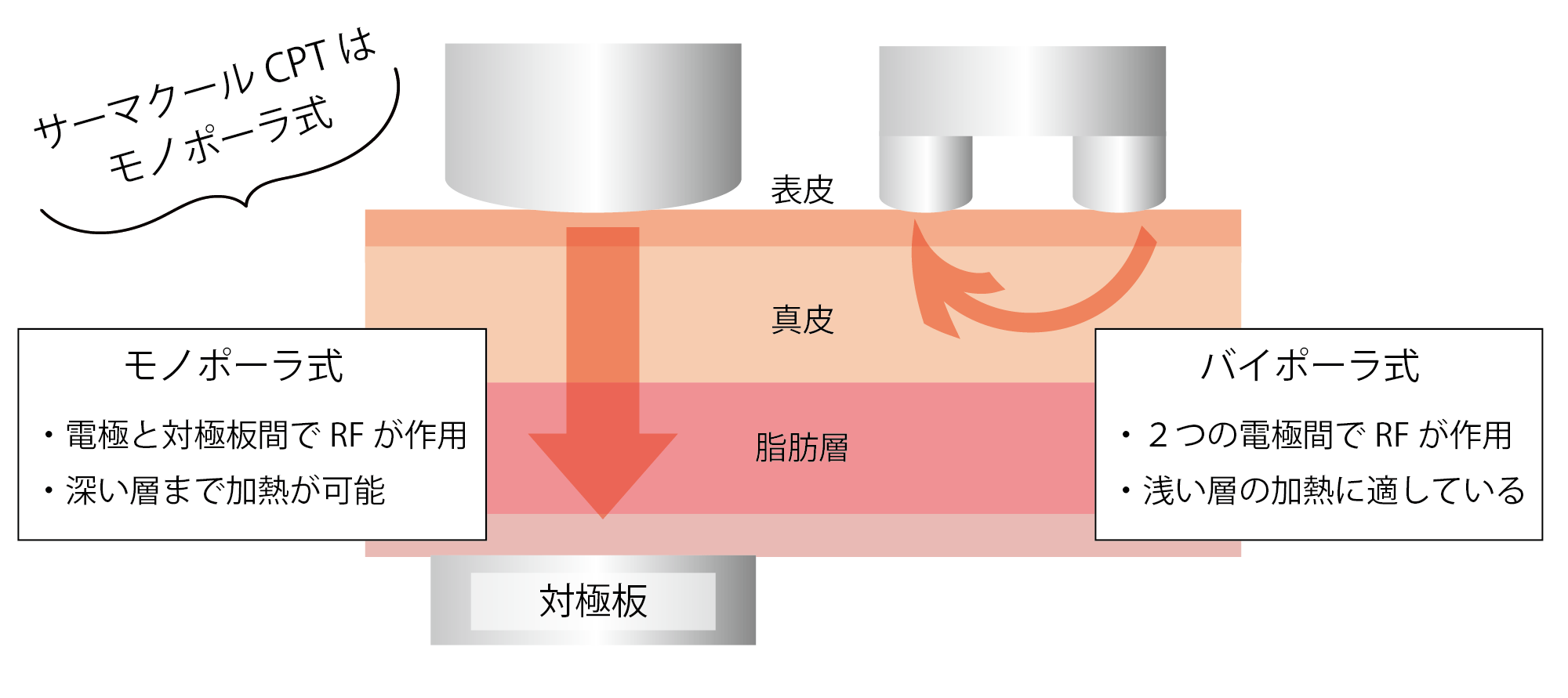 モノポーラとバイポーラの違い.png